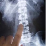 hayward car accident rehabilitation