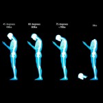 tex neck and chiropractic care